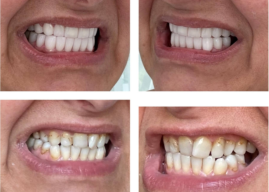 Life-Changing Transformation